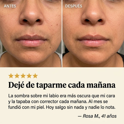 NALYA™ — Sérum Antimanchas · Vitamina C Pura + Glutatión